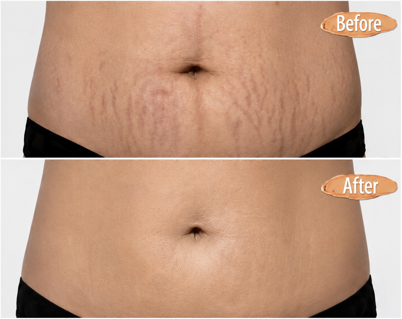 Body Coverage Perfector Confidence in Every Outfit