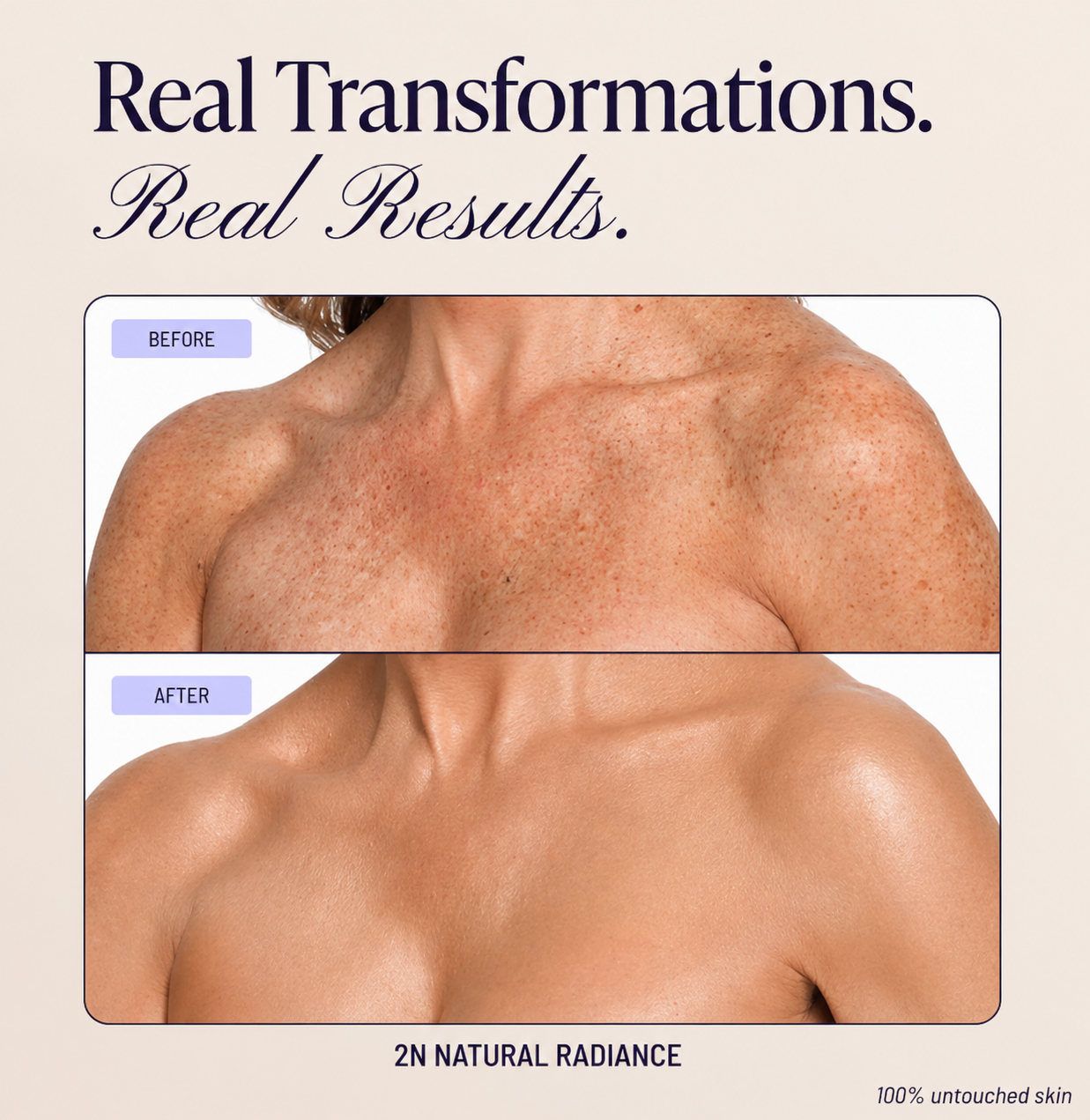 Body Coverage Perfector Confidence in Every Outfit